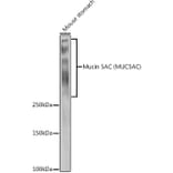 Western Blot - Anti-Mucin 5AC Antibody (A92648) - Antibodies.com