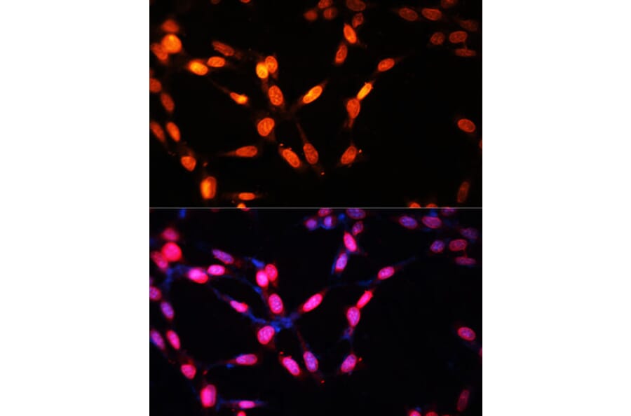 Immunofluorescence - Anti-Myogenin Antibody (A92649) - Antibodies.com