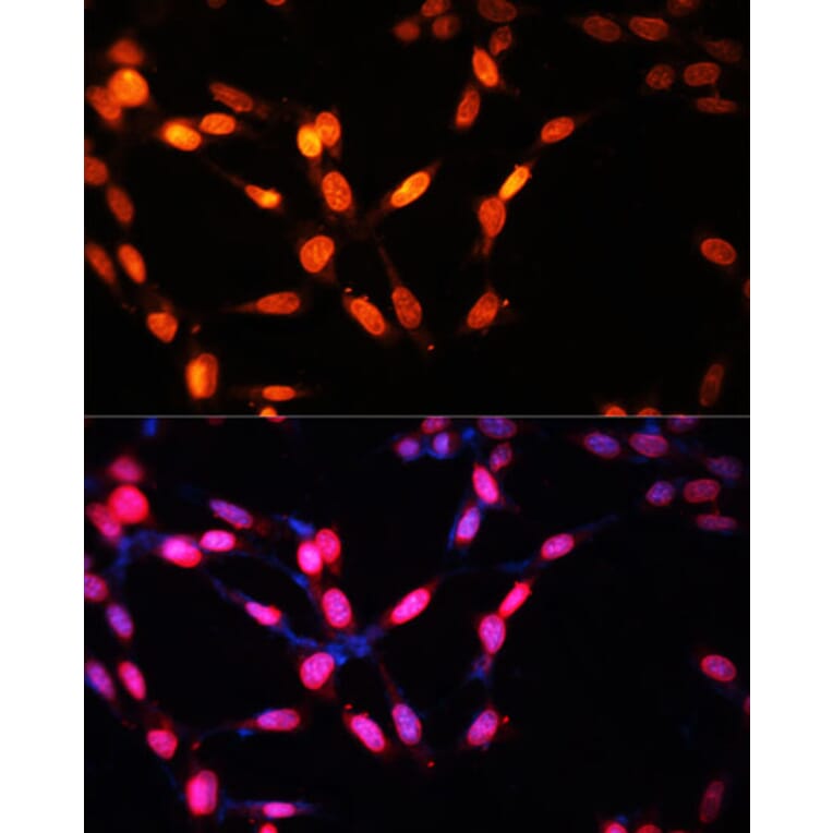 Immunofluorescence - Anti-Myogenin Antibody (A92649) - Antibodies.com