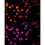 Immunofluorescence - Anti-Myogenin Antibody (A92649) - Antibodies.com