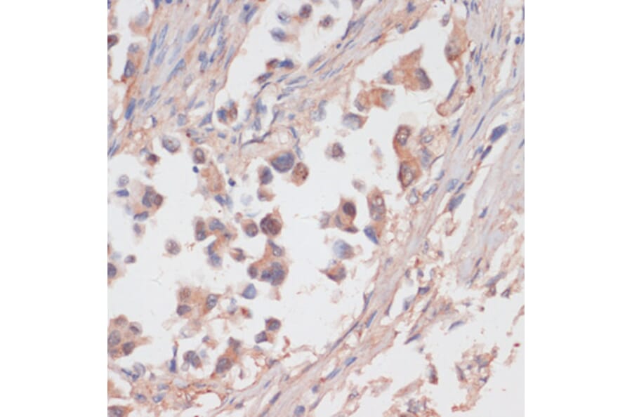 Immunohistochemistry - Anti-NCSTN Antibody (A17111) - Antibodies.com