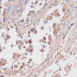 Immunohistochemistry - Anti-NCSTN Antibody (A17111) - Antibodies.com
