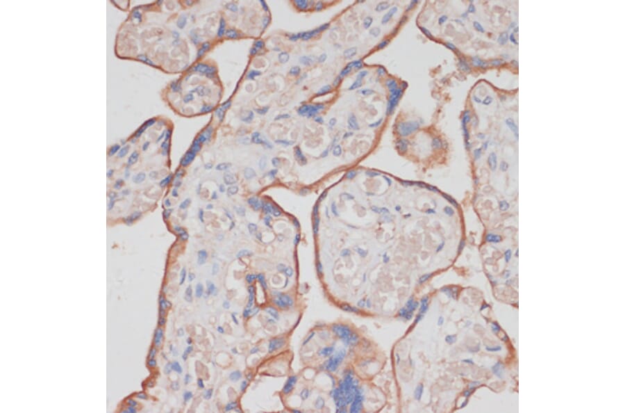 Immunohistochemistry - Anti-NCSTN Antibody (A17111) - Antibodies.com