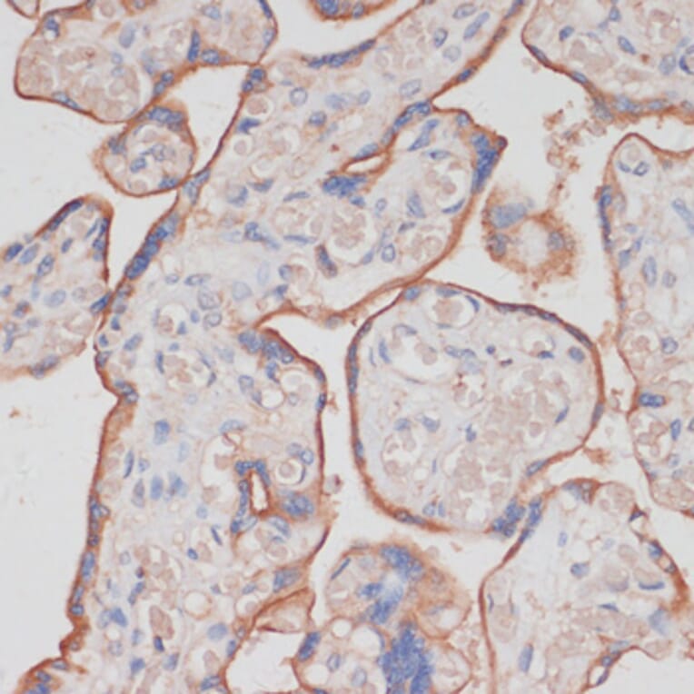 Immunohistochemistry - Anti-NCSTN Antibody (A17111) - Antibodies.com