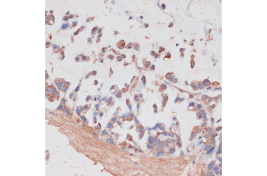 Immunohistochemistry - Anti-NCSTN Antibody (A17111) - Antibodies.com