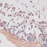 Immunohistochemistry - Anti-NCSTN Antibody (A17111) - Antibodies.com