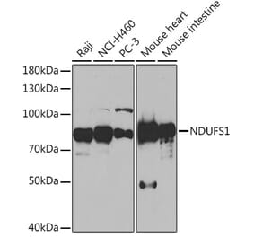 Western Blot - Anti-Ndufs1 Antibody (A92653) - Antibodies.com