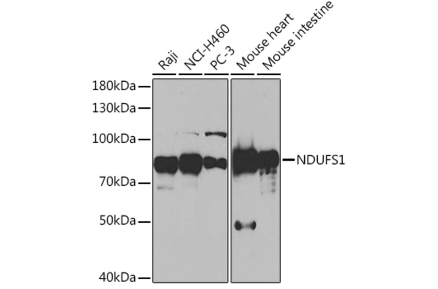 Western Blot - Anti-Ndufs1 Antibody (A92653) - Antibodies.com