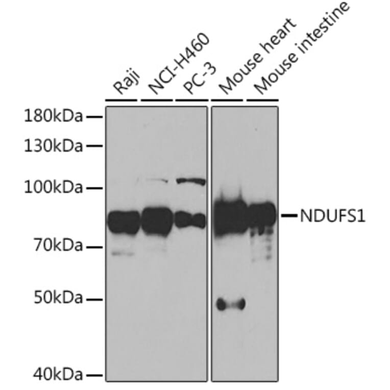 Western Blot - Anti-Ndufs1 Antibody (A92653) - Antibodies.com