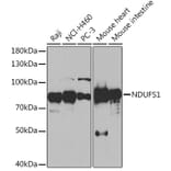 Western Blot - Anti-Ndufs1 Antibody (A92653) - Antibodies.com