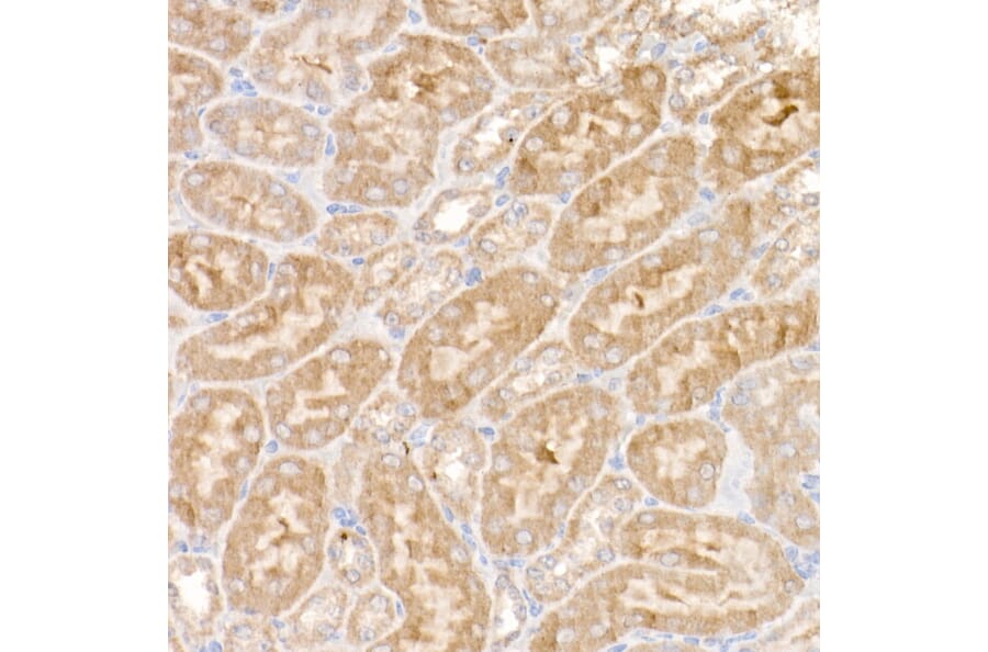 Immunohistochemistry - Anti-Ndufs1 Antibody (A92653) - Antibodies.com