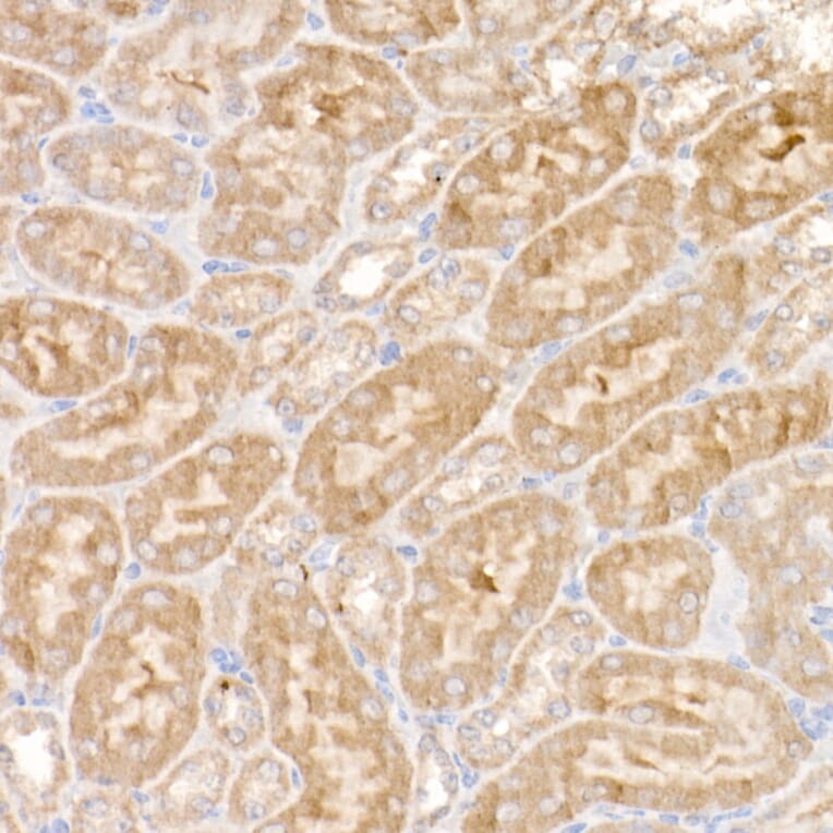 Immunohistochemistry - Anti-Ndufs1 Antibody (A92653) - Antibodies.com