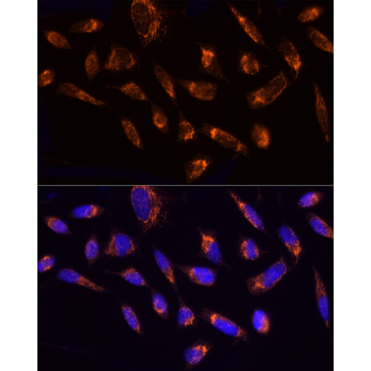 Immunofluorescence - Anti-Ndufs1 Antibody (A92653) - Antibodies.com