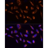 Immunofluorescence - Anti-Ndufs1 Antibody (A92653) - Antibodies.com