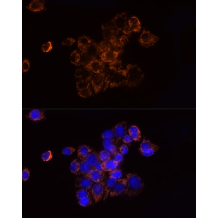 Immunofluorescence - Anti-Ndufs1 Antibody (A92653) - Antibodies.com