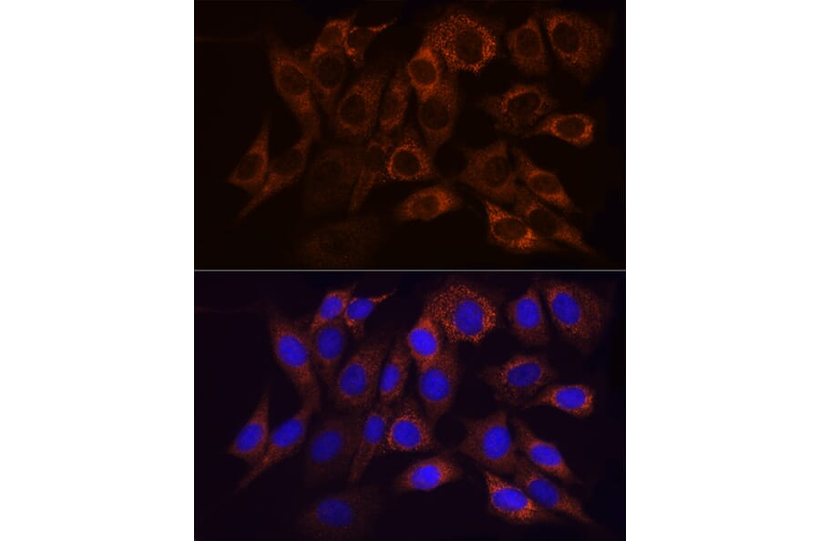 Immunofluorescence - Anti-Ndufs1 Antibody (A92653) - Antibodies.com