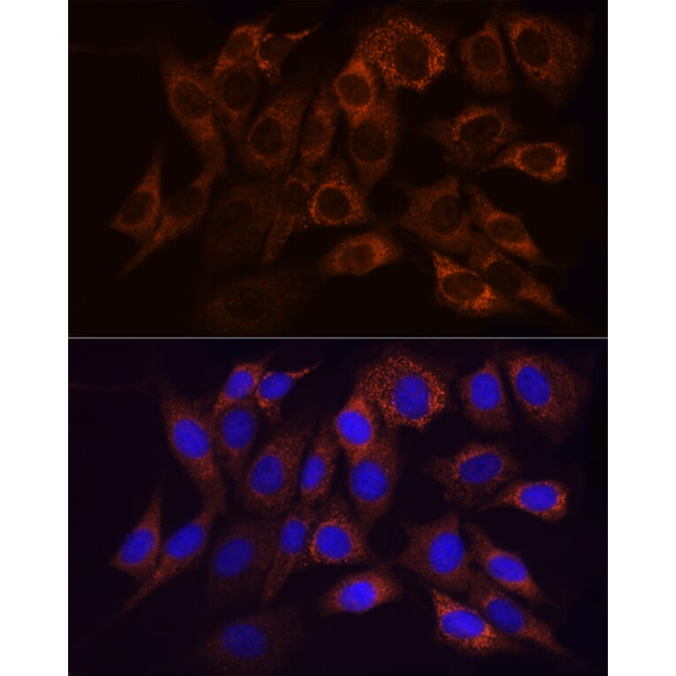 Immunofluorescence - Anti-Ndufs1 Antibody (A92653) - Antibodies.com