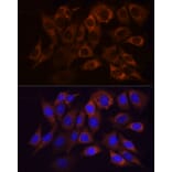 Immunofluorescence - Anti-Ndufs1 Antibody (A92653) - Antibodies.com