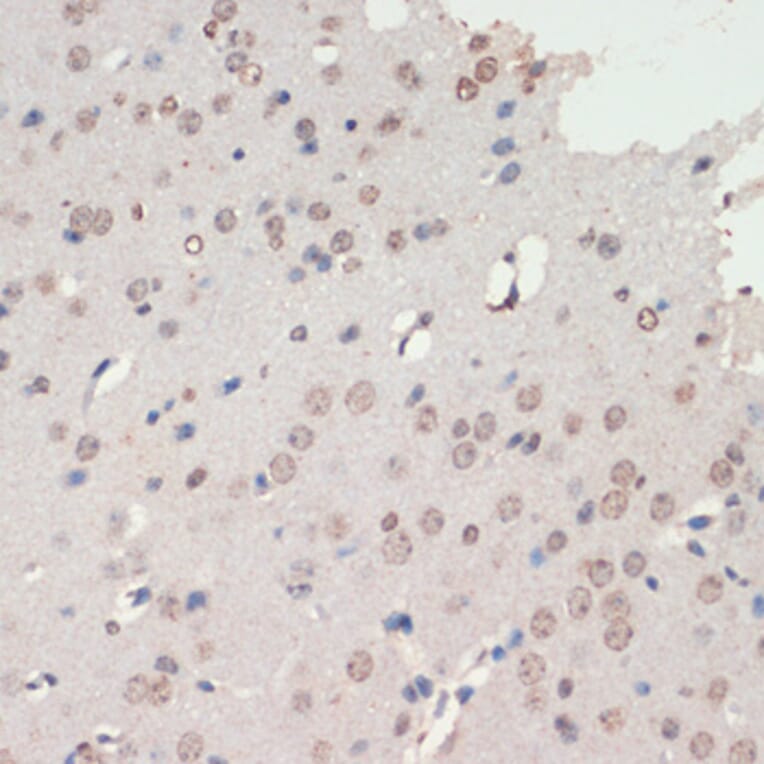 Immunohistochemistry - Anti-NeuroD1 Antibody (A92656) - Antibodies.com