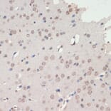 Immunohistochemistry - Anti-NeuroD1 Antibody (A92656) - Antibodies.com
