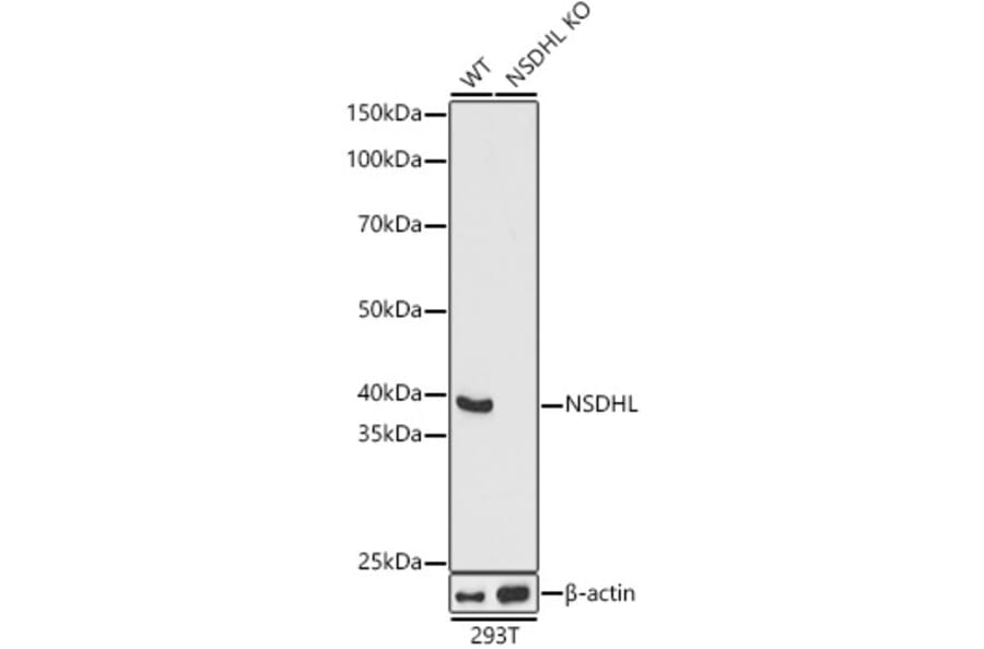 Western Blot - Anti-NSDHL Antibody (A92660) - Antibodies.com