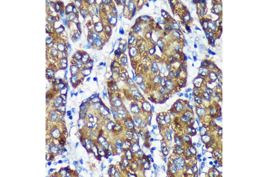 Immunohistochemistry - Anti-NSDHL Antibody (A92660) - Antibodies.com