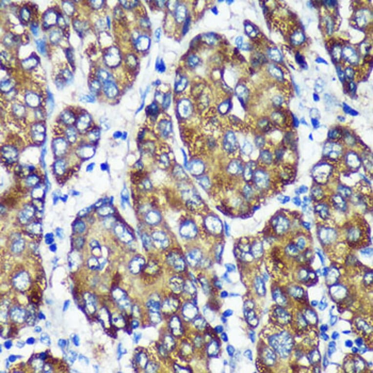 Immunohistochemistry - Anti-NSDHL Antibody (A92660) - Antibodies.com