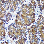 Immunohistochemistry - Anti-NSDHL Antibody (A92660) - Antibodies.com