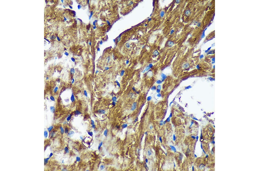 Immunohistochemistry - Anti-NSDHL Antibody (A92660) - Antibodies.com
