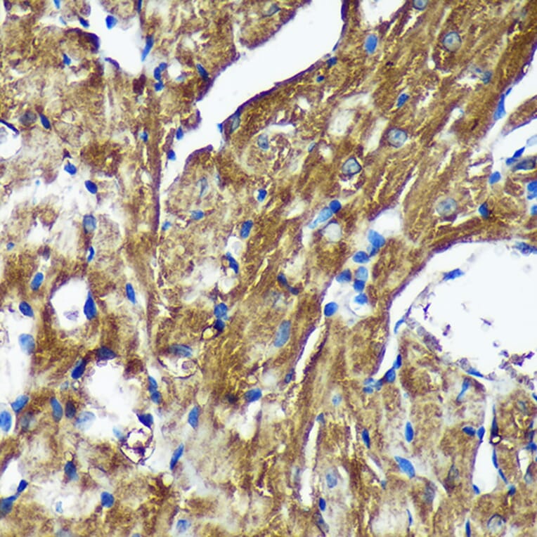 Immunohistochemistry - Anti-NSDHL Antibody (A92660) - Antibodies.com