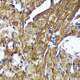Immunohistochemistry - Anti-NSDHL Antibody (A92660) - Antibodies.com