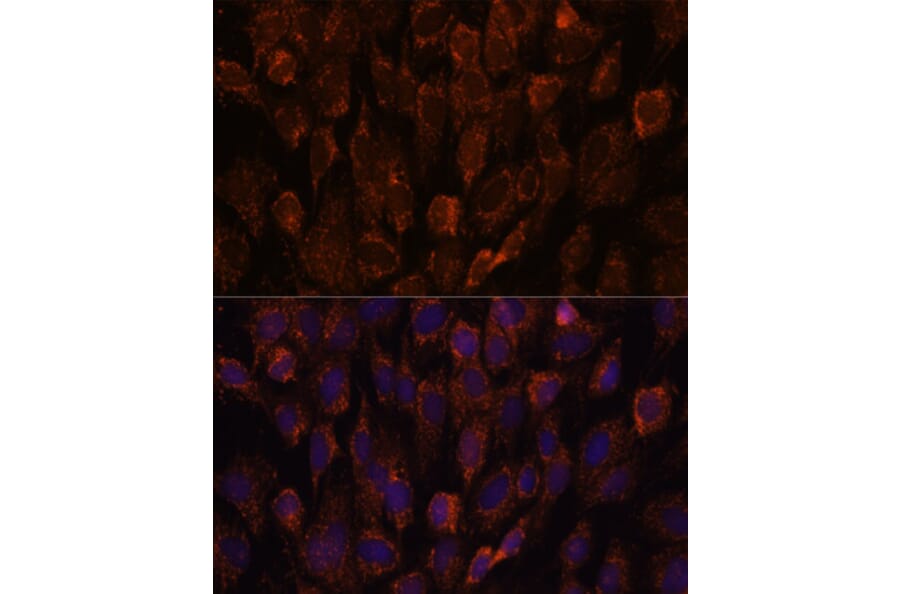 Immunofluorescence - Anti-NSDHL Antibody (A92660) - Antibodies.com
