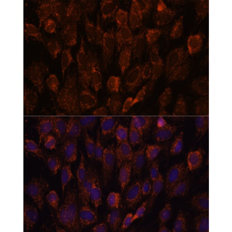 Immunofluorescence - Anti-NSDHL Antibody (A92660) - Antibodies.com