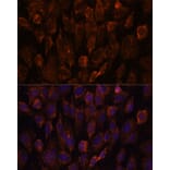 Immunofluorescence - Anti-NSDHL Antibody (A92660) - Antibodies.com