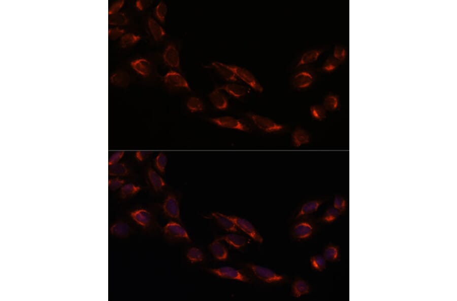 Immunofluorescence - Anti-NSDHL Antibody (A92660) - Antibodies.com