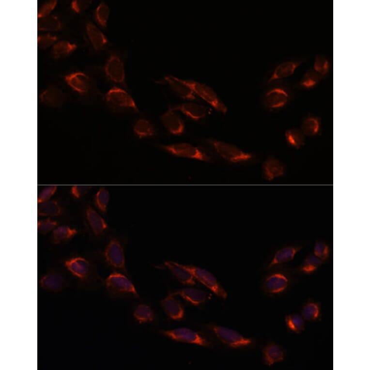 Immunofluorescence - Anti-NSDHL Antibody (A92660) - Antibodies.com