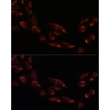 Immunofluorescence - Anti-NSDHL Antibody (A92660) - Antibodies.com
