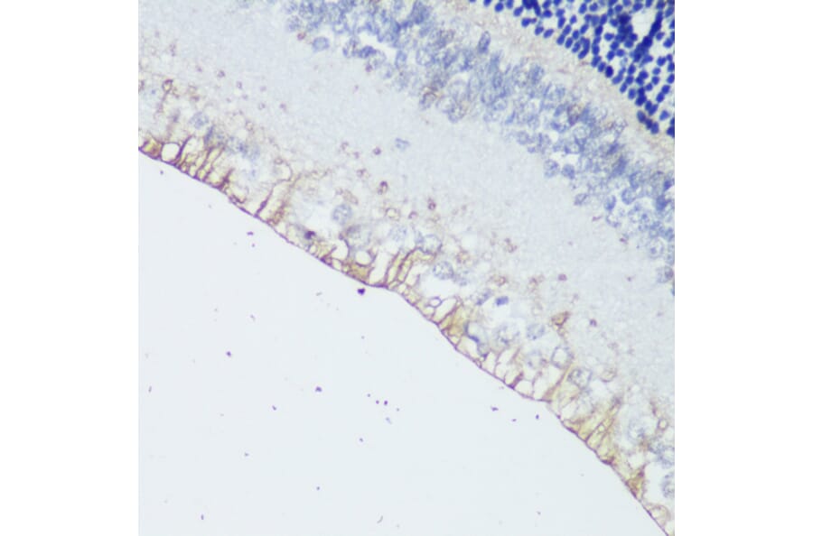 Immunohistochemistry - Anti-Melanopsin Antibody (A92661) - Antibodies.com