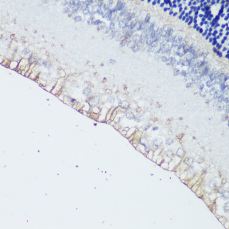 Immunohistochemistry - Anti-Melanopsin Antibody (A92661) - Antibodies.com