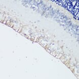 Immunohistochemistry - Anti-Melanopsin Antibody (A92661) - Antibodies.com