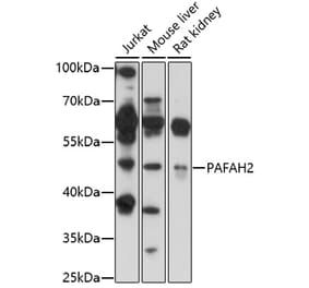 Western Blot - Anti-PAFAH2 Antibody (A92662) - Antibodies.com