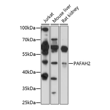 Western Blot - Anti-PAFAH2 Antibody (A92662) - Antibodies.com