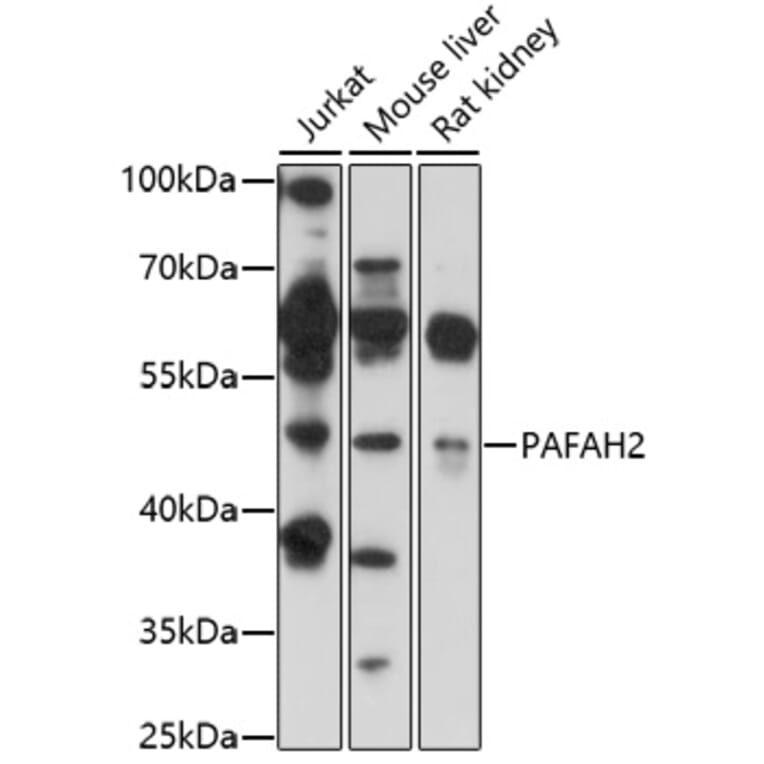 Western Blot - Anti-PAFAH2 Antibody (A92662) - Antibodies.com