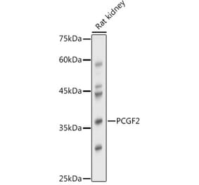 Western Blot - Anti-Mel18 Antibody (A92664) - Antibodies.com
