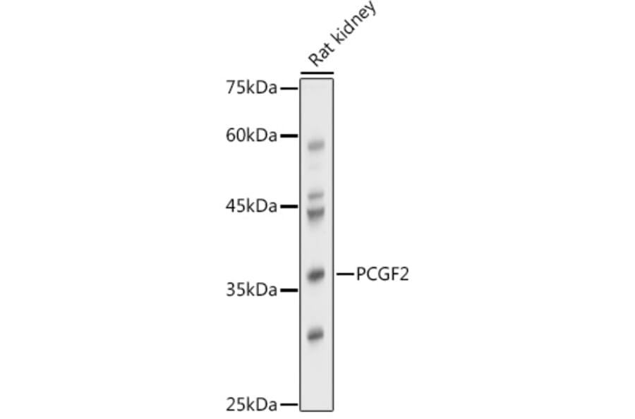 Western Blot - Anti-Mel18 Antibody (A92664) - Antibodies.com