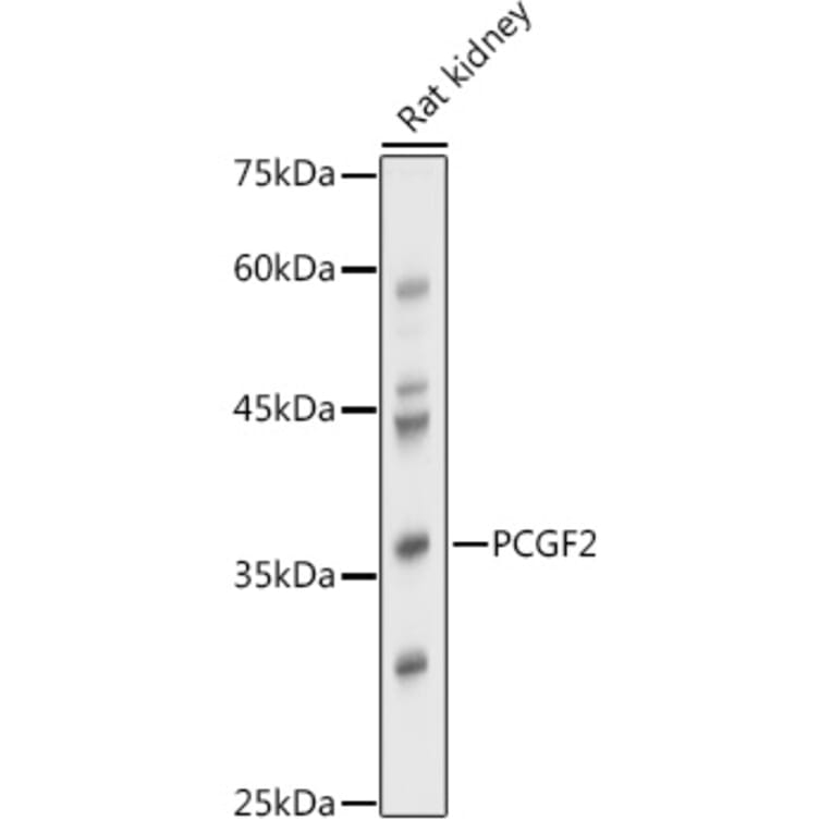 Western Blot - Anti-Mel18 Antibody (A92664) - Antibodies.com