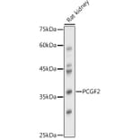 Western Blot - Anti-Mel18 Antibody (A92664) - Antibodies.com