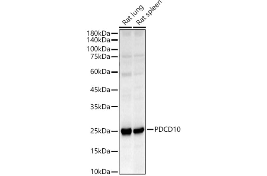 Western Blot - Anti-PDCD10/CCM3 Antibody (A92665) - Antibodies.com