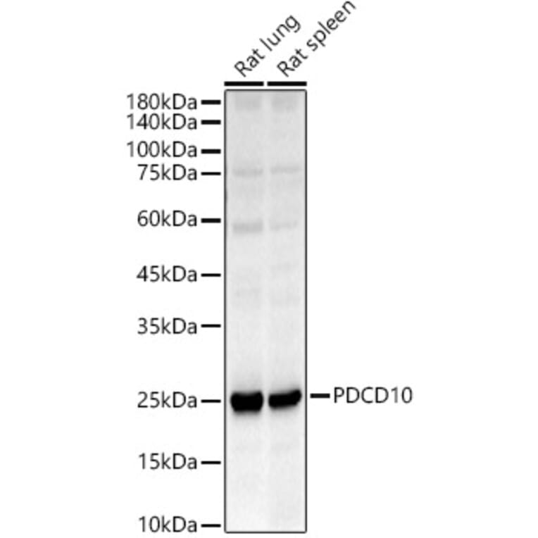 Western Blot - Anti-PDCD10/CCM3 Antibody (A92665) - Antibodies.com