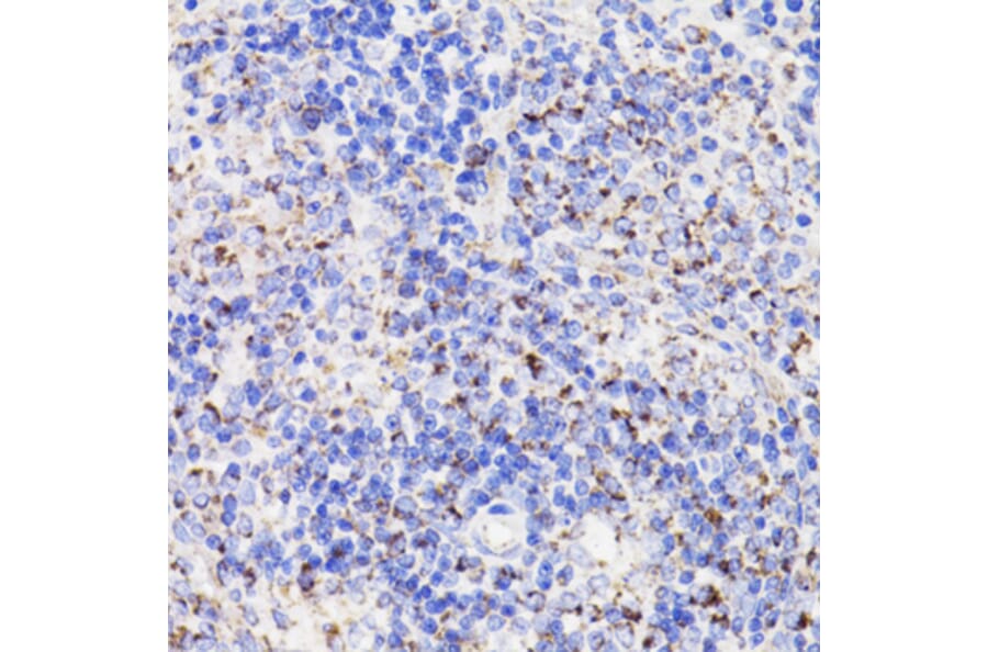 Immunohistochemistry - Anti-PDCD10/CCM3 Antibody (A92665) - Antibodies.com